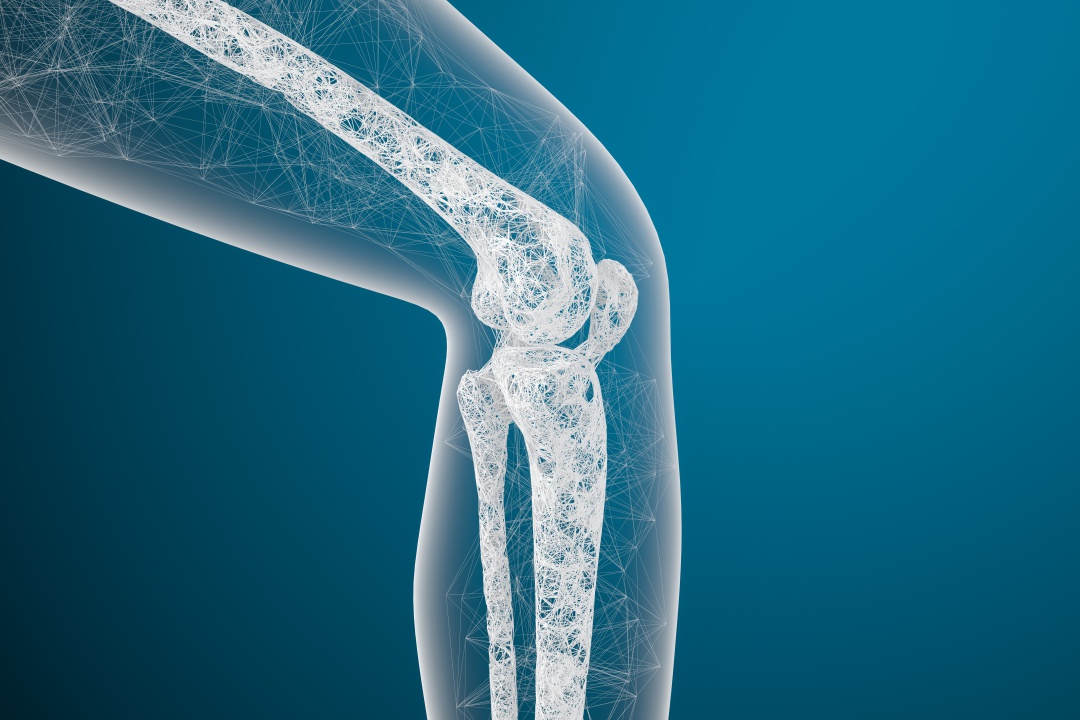 Osteoporóza: Které léky a cvičení mohou pomoci při osteoporóze? - 01